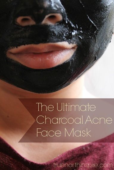 The Ultimate Charcoal Acne Face Mask
