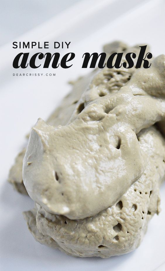 Simple DIY Acne Mask