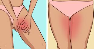 Stop your thighs from rubbing hack